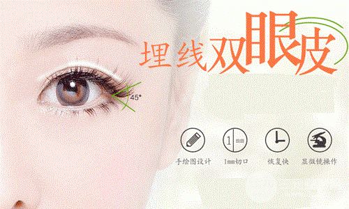 雙眼皮埋線(xiàn)價(jià)格多少錢(qián)？受到這幾個(gè)因素影響！
