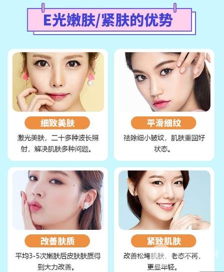 e光嫩膚優(yōu)勢(shì)