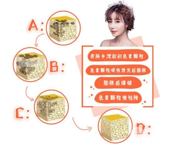 做完黑臉娃娃要注意什么?