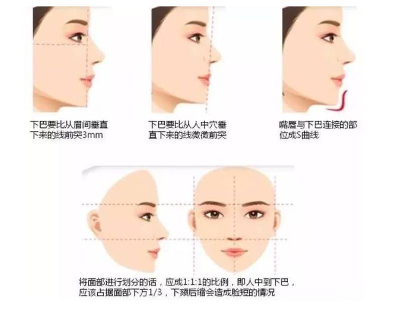 墊下巴后注意事項需謹(jǐn)記，不要因為這些細(xì)節(jié)而釀成大錯!