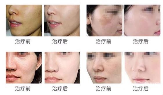 術者自身條件不同