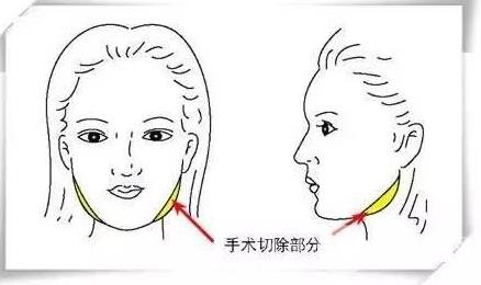 自身條件不同