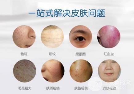 光子嫩膚哪家醫(yī)院好 謹(jǐn)記這幾點很重要~