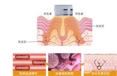 光子嫩膚哪家醫(yī)院好 謹(jǐn)記這幾點很重要~