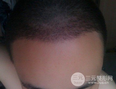 ?？谌嗣襻t(yī)院美容科