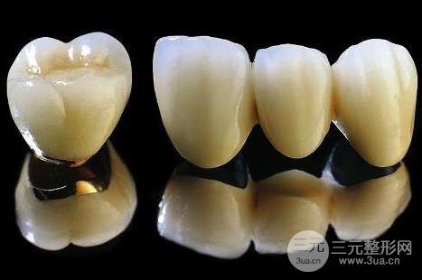 北京烤瓷牙價格貴不貴，受到以下三點因素影響~