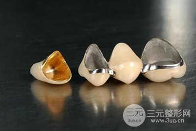 北京烤瓷牙價格貴不貴，受到以下三點因素影響~