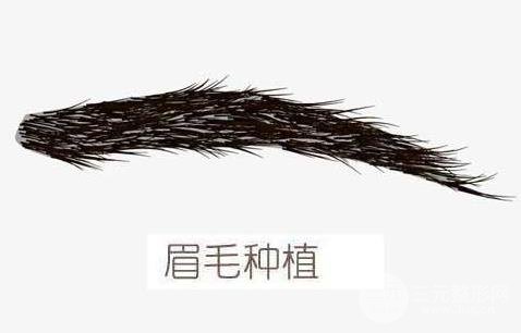 種植眉毛前的注意事項(xiàng)