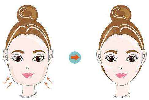 面部吸脂整形多久恢復(fù)自然？科普一下吧~