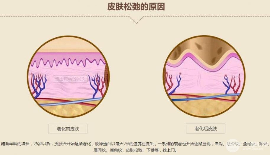 怎么樣去抬頭紋？這個方法才是真·有！