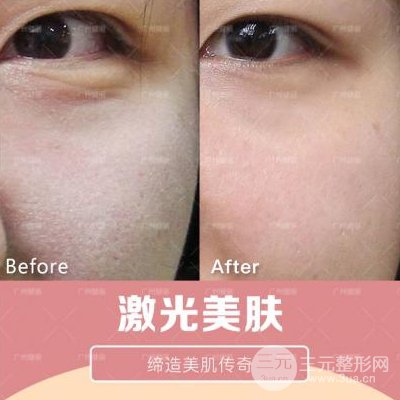 e光嫩膚多少錢？簡單有的護(hù)膚方法~