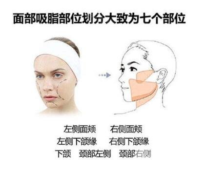 光纖溶脂瘦臉是長時間的嗎？維持時間是多長？
