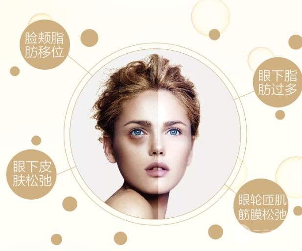 內(nèi)切去眼袋多久恢復(fù)期?
