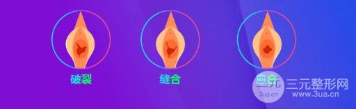 處女膜修復(fù)時機(jī)