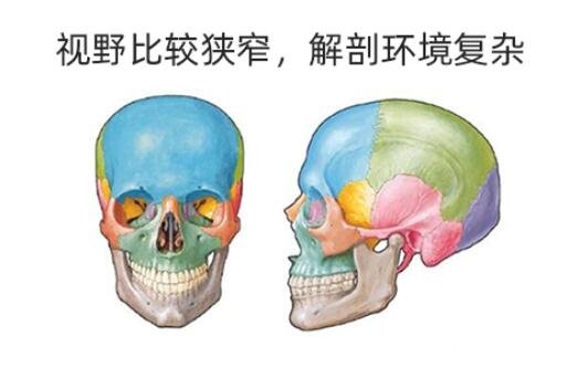 磨骨瘦臉恢復(fù)時(shí)間?