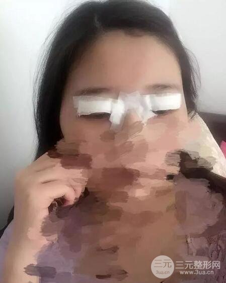 新星靚劉風卓眼修復