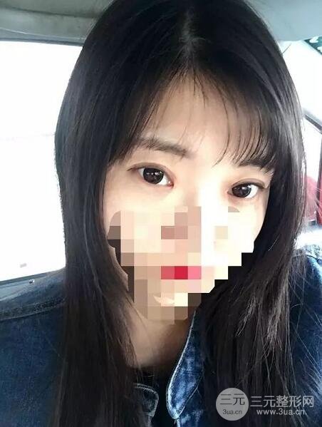 新星靚劉風卓眼修復