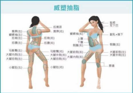 威塑抽脂和水動(dòng)力吸脂區(qū)別