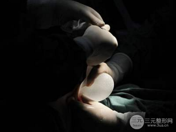 娜綺麗和曼托假體哪個(gè)好