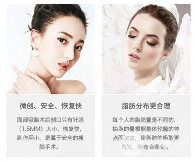 面部吸脂的果怎么樣