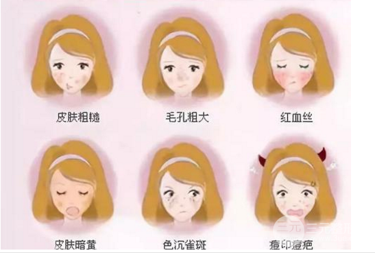光子嫩膚緩解酒糟鼻
