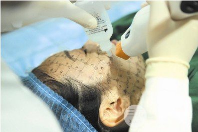 熱瑪吉除皺果多久