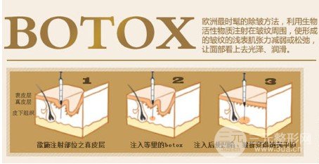 ****注射瘦臉價格