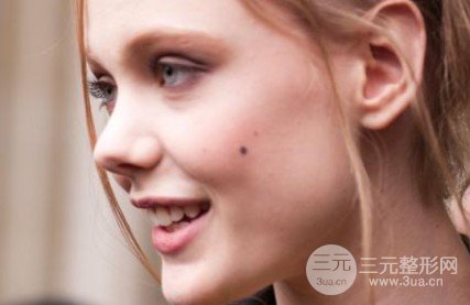 去痣多少錢一顆