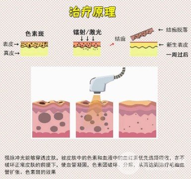復合彩光嫩膚的作用