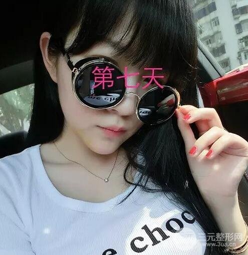 手術(shù)前的準(zhǔn)備