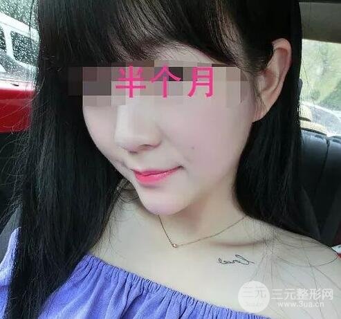 手術(shù)前的準(zhǔn)備