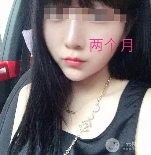 手術(shù)后