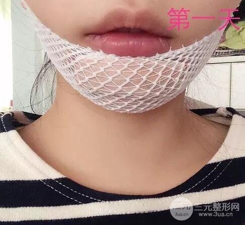 選擇墊下巴