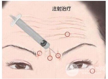 脂肪填充額頭對比圖