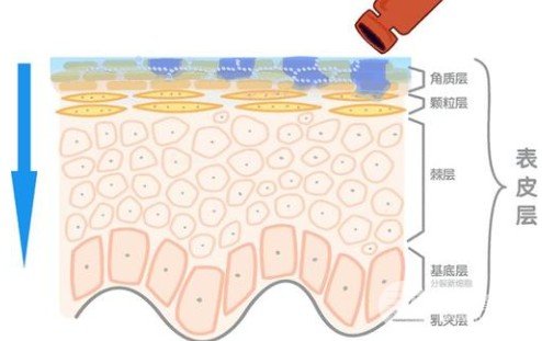 玻尿酸隆鼻到底能保持多久