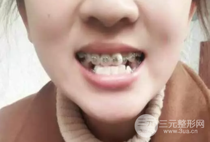 邵陽(yáng)雅貝康口腔醫(yī)院價(jià)目表