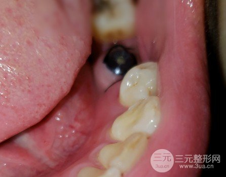 邵陽(yáng)雅貝康口腔醫(yī)院價(jià)目表