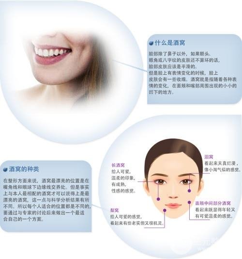酒窩成型手術(shù)方法