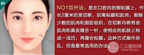 酒窩成型手術(shù)方法