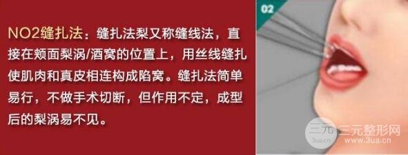 酒窩成型手術(shù)方法