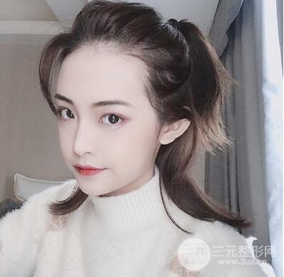 恢復(fù)期間
