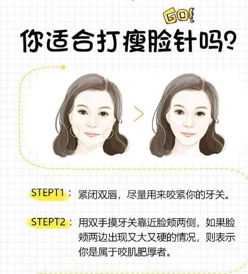 注射瘦臉的優(yōu)勢