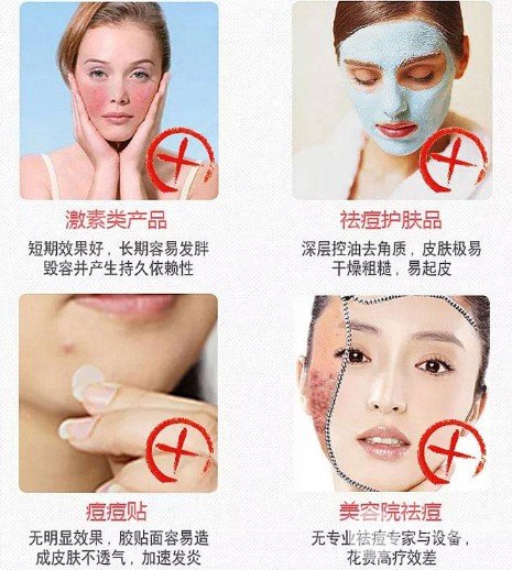激光緩解痤瘡大概多少錢(qián)