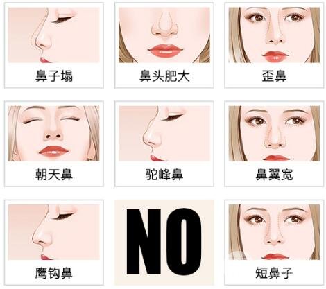 什么是蒜頭鼻