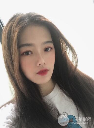 手術(shù)后4~7天