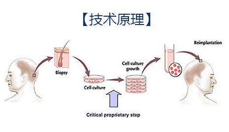 鄭州植發(fā)正規(guī)醫(yī)院案例記錄