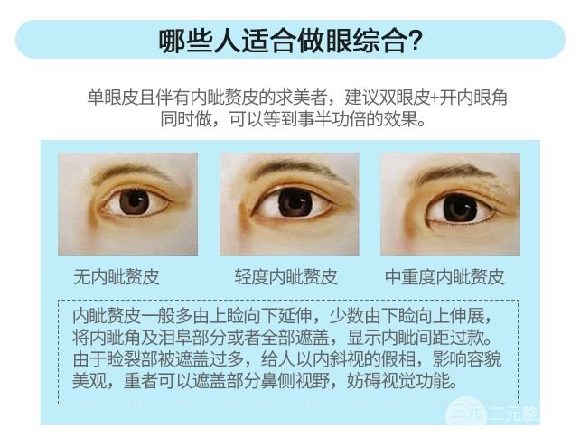 雙眼皮多項(xiàng)整形多長時(shí)間能美妝