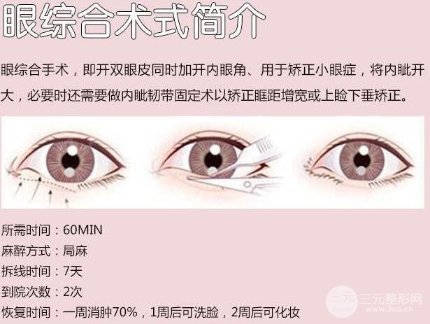 雙眼皮多項(xiàng)整形多長時(shí)間能美妝