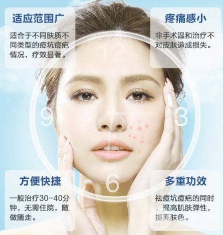 激光去痘印價(jià)格多少