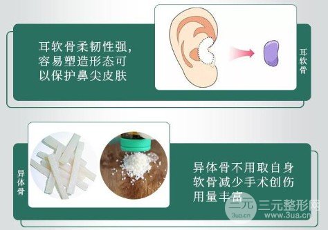 耳軟骨墊鼻尖多久消腫